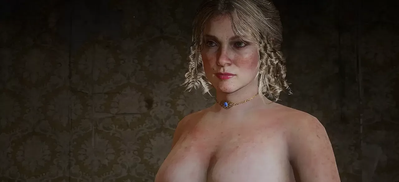 Karen nipples restored  凯伦乳房修复